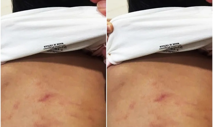 Vụ bé gái 2 tuổi ở Cà Mau bị bạo hành: Sức khỏe nạn nhân hiện ra sao?