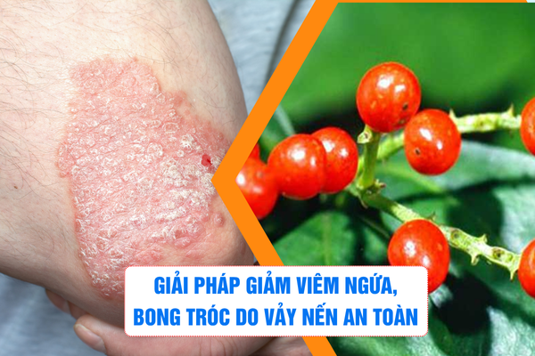 Giải pháp giảm viêm ngứa, bong tróc do vảy nến an toàn