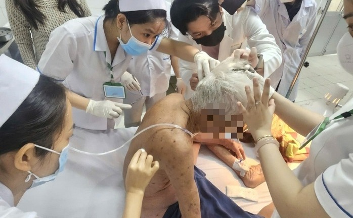 Cụ ông 74 tuổi tử vong thương tâm do ong đốt hơn 100 vết