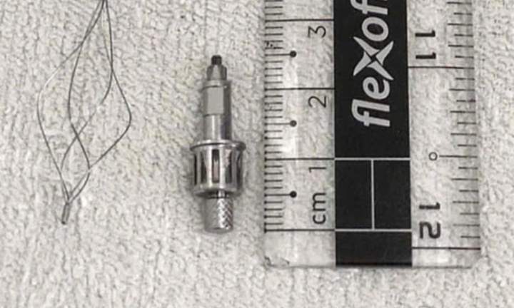 Tin tức đời sống 27/11:  Cụ ông bị dụng cụ nha khoa rơi vào phổi khi làm răng