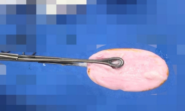 Tin tức đời sống 2/12: Người đàn ông 49 tuổi bất ngờ ngã gục khi đang nhậu