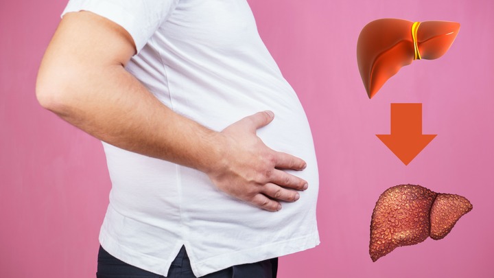 Những dấu hiệu cảnh báo suy gan