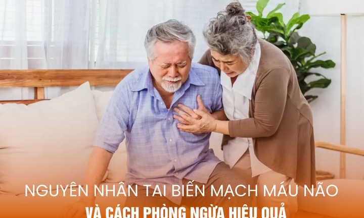 Nguyên nhân tai biến mạch máu não và cách phòng ngừa hiệu quả