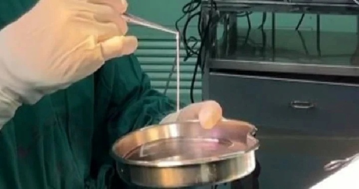 Người đàn ông mắc động kinh 20 năm, kết quả chụp não hé lộ thứ