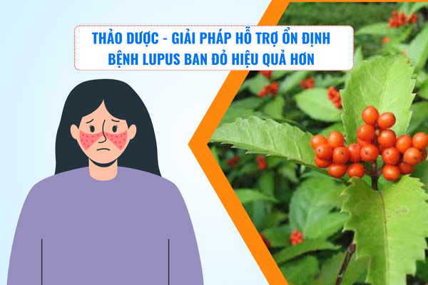 Thảo dược - Giải pháp hỗ trợ ổn định bệnh lupus ban đỏ hiệu quả hơn
