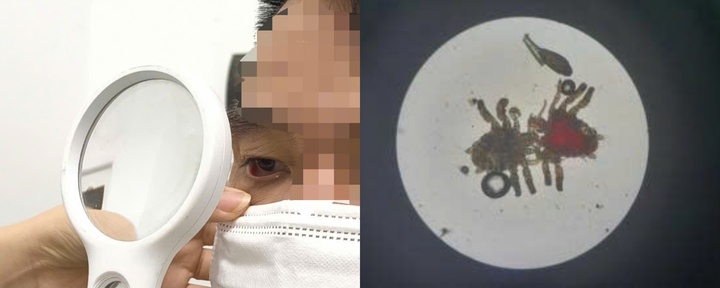 Người đàn ông tá hỏa phát hiện 