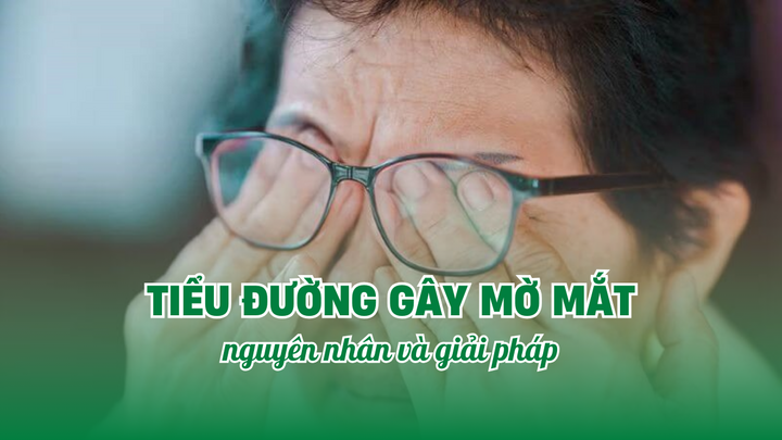 Tiểu đường gây mờ mắt: Nguyên nhân và giải pháp bảo vệ thị lực hiệu quả