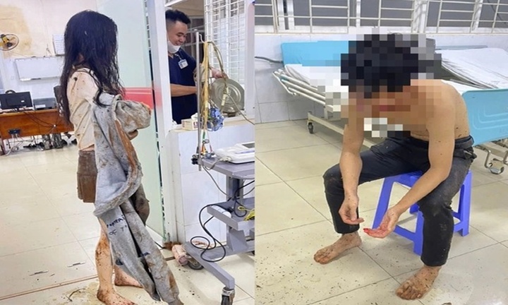 Tin tức thời sự 24h: Giải cứu đôi nam nữ rơi xuống giếng hoang