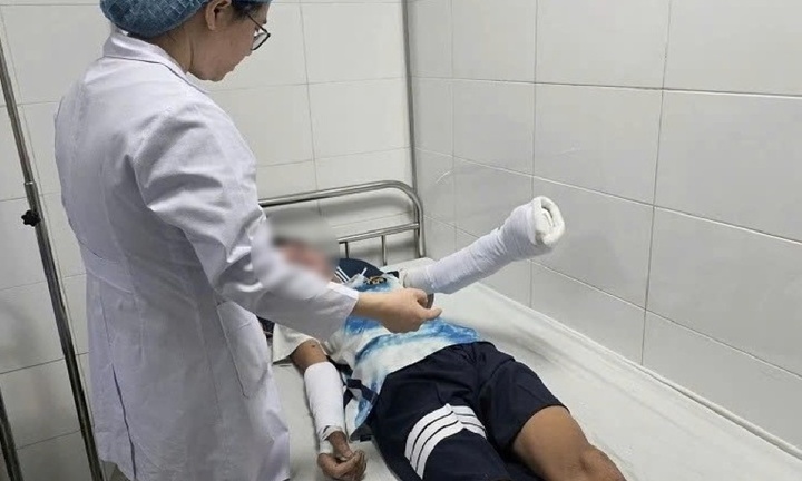 Nam sinh 14 tuổi bị thương nặng do tự chế pháo bằng lưu huỳnh theo video trên mạng