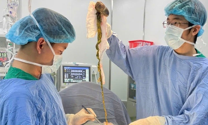 Kỳ lạ hội chứng ăn tóc: Búi tóc 