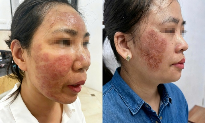 Làm đẹp đón tết: Đừng để 