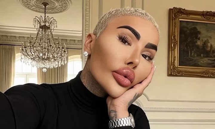 “Vua môi” tử vong không rõ nguyên nhân trong căn biệt thự cao cấp, 2 người bị bắt