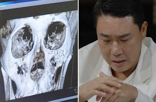 Nam ca sĩ đình đám ẩu đả kinh hoàng trong quán nhậu đến mức nhập viện