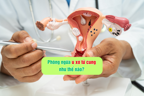 Phòng ngừa u xơ tử cung như thế nào?