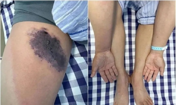 Mặc quần cũ không giũ, người đàn ông suýt mất mạng vì một