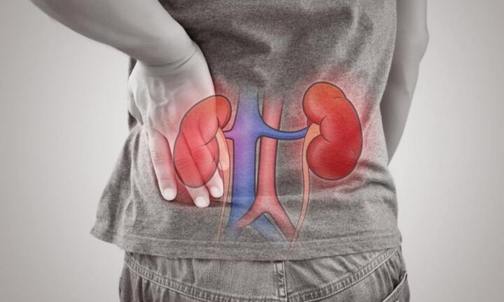 Ăn nhạt, không thuốc lá, người đàn ông vẫn bị suy thận giai đoạn vì sai lầm này
