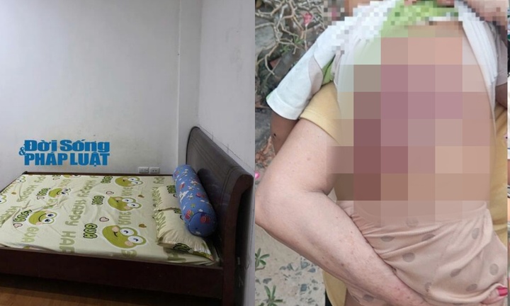 Liên tiếp trẻ bị bạo hành nghiêm trọng: Bộ Y tế chỉ đạo 