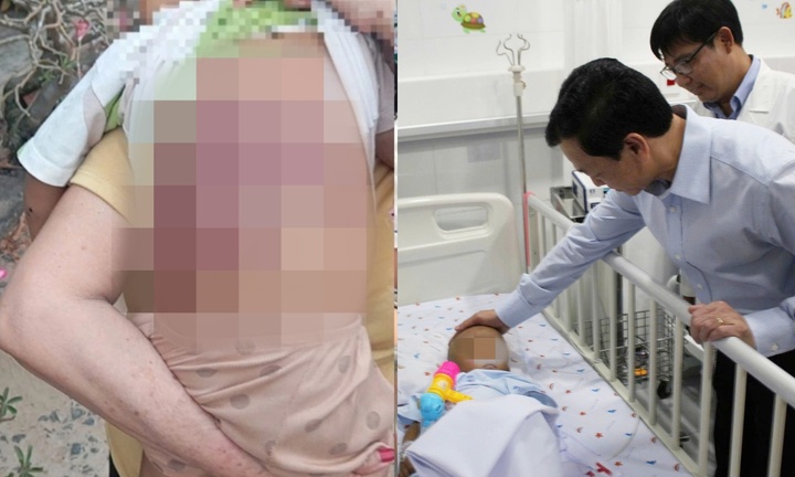 Thứ trưởng Bộ Y tế: Bạo hành trẻ em là “tội phạm ẩn”, cần phòng ngừa từ gốc