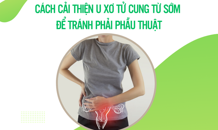Cách cải thiện u xơ tử cung từ sớm để tránh phải phẫu thuật