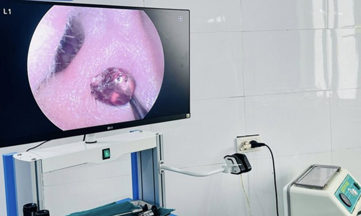 Đau tai đi khám, bệnh nhân hoảng hốt vì