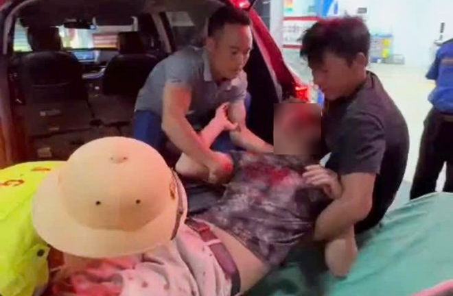Tin tức thời sự 24h: CSGT hỗ trợ đưa người bị chấn thương nặng đi cấp cứu