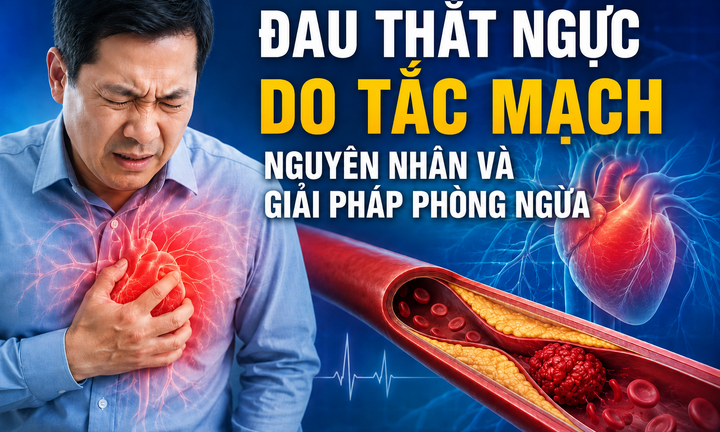 Đau thắt ngực do tắc mạch: Nguyên nhân và giải pháp phòng ngừa