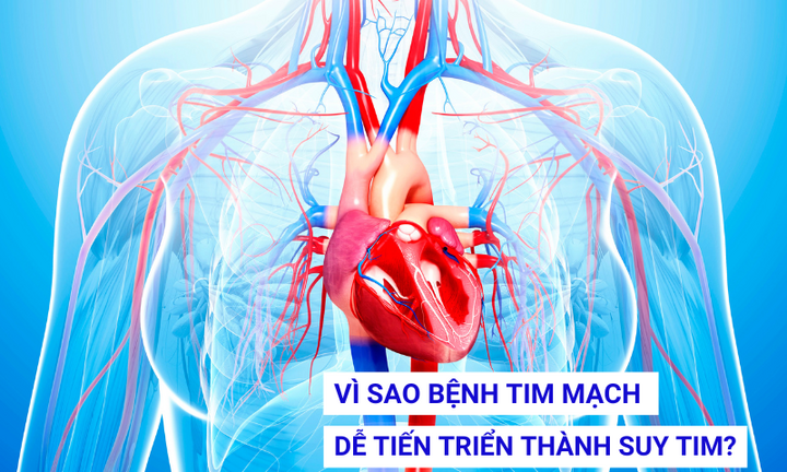 Vì sao bệnh tim mạch dễ tiến triển thành suy tim? 