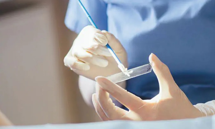 Bộ Y tế hướng dẫn kỹ thuật 15 phút giúp phát hiện sớm ung thư cổ tử cung