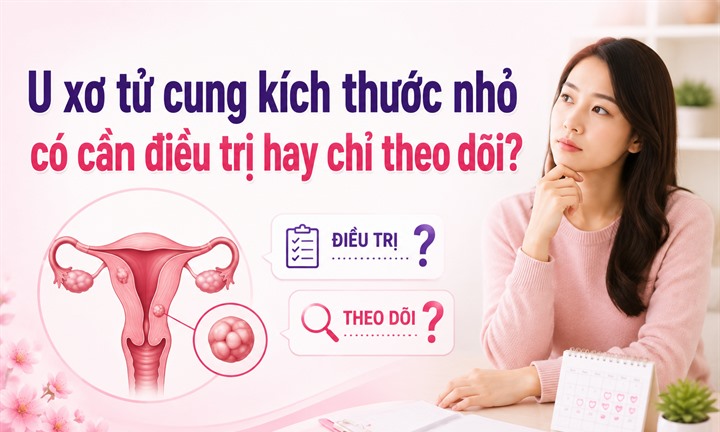 U xơ tử cung kích thước nhỏ có cần điều trị hay chỉ theo dõi?