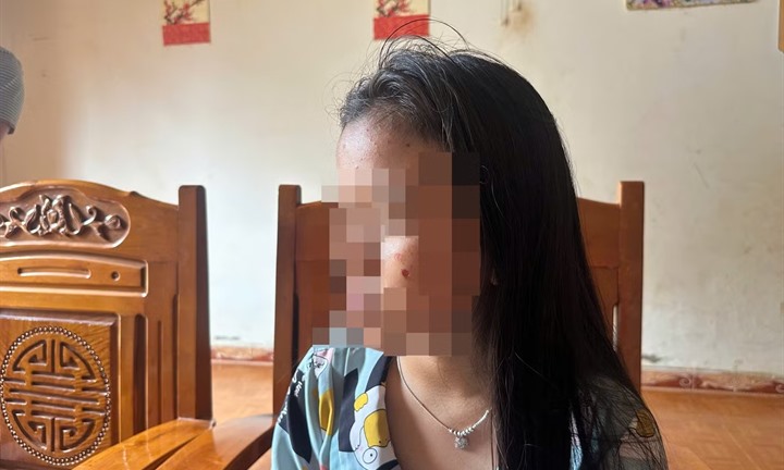 Vụ nữ sinh bị bạn đánh, dí thuốc lá vào mặt: Xót xa lời của ông nội