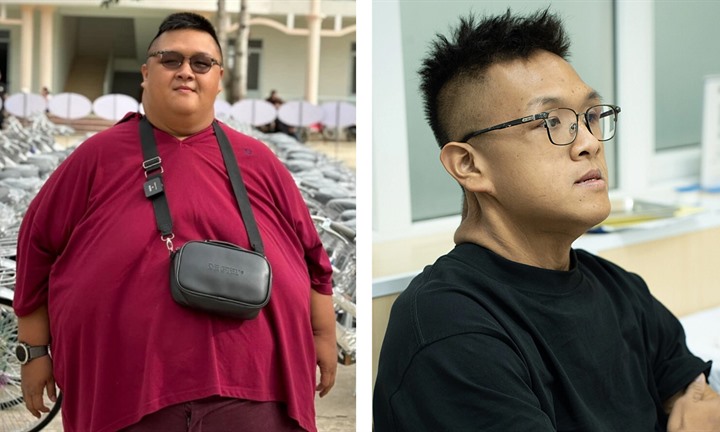 Chàng trai giảm hơn 160kg, cắt 17kg da thừa 