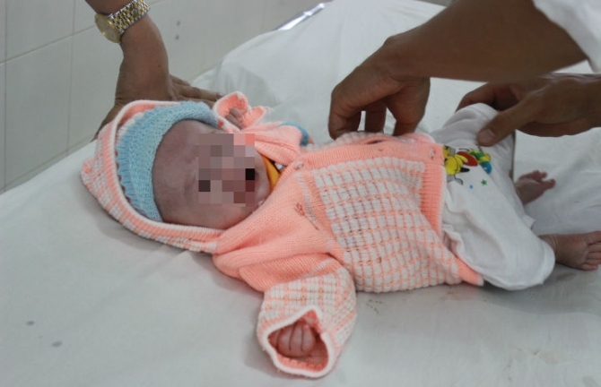 Cháu bé không có hậu môn được về trung tâm cô nhi