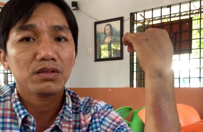 Con trai Giám đốc CA tỉnh Cà Mau: 