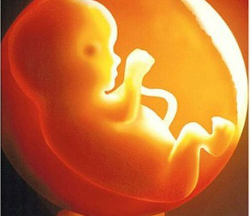 Làm mẹ tập 44: Bệnh lý liên quan đến nước ối