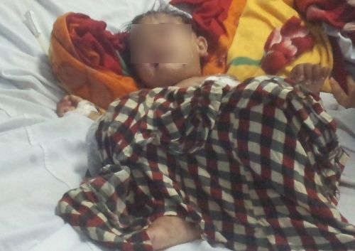 Bé 2 tuổi bị chảo rán cá đầy dầu sôi đổ lên người