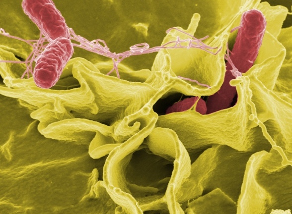 Bé gái tử vong do nhiễm bệnh thương hàn