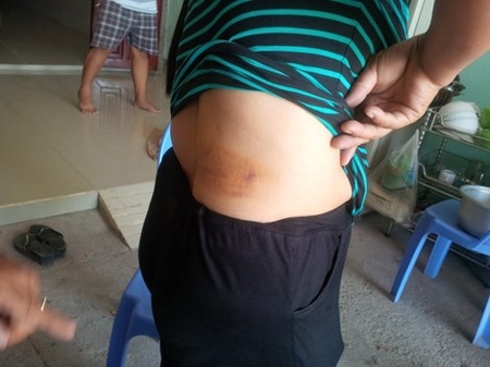 Nhóm côn đồ lao vào chém, ném bom xăng truy sát 1 gia đình