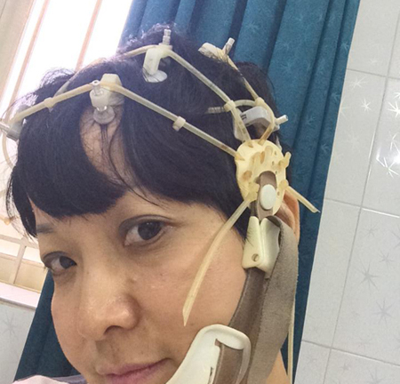 MC Thảo Vân uống thuốc thần kinh để khôi phục trí nhớ