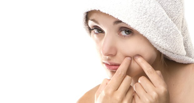 Bí quyết chăm sóc da dầu, mụn vào mùa hè