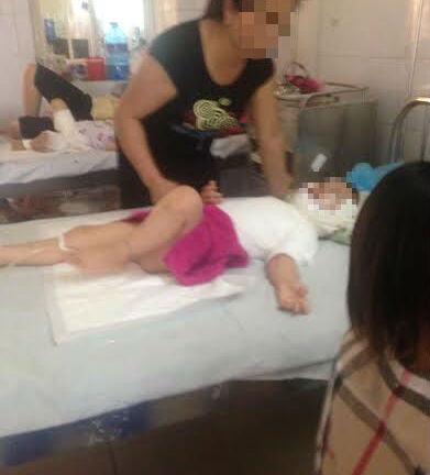 Bé bị bỏng tại trường mầm non: Mẹ không muốn truy cứu