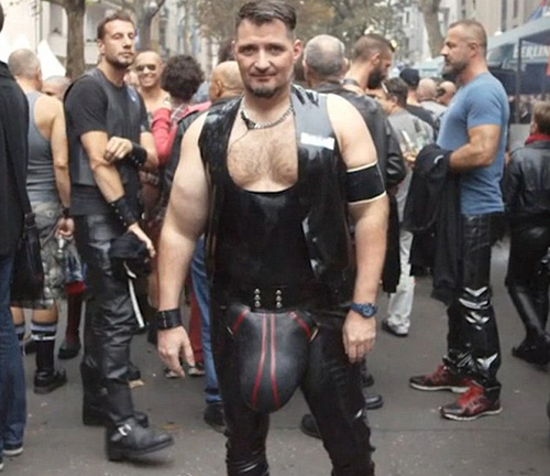 Khốn khổ vì “của quý” nặng tới hơn 4kg