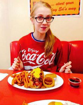 Hình ảnh gầy gò khủng khiếp của cô gái nghiện giảm cân