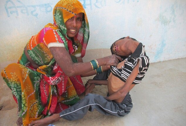 Cha mẹ đau đớn chứng kiến con trai 'sống không bằng chết'