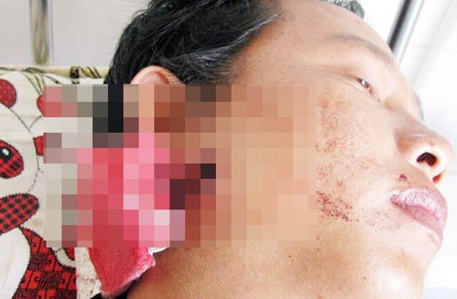 Vụ thanh niên trúng đạn từ súng trung tá công an:Yêu cầu xử lại