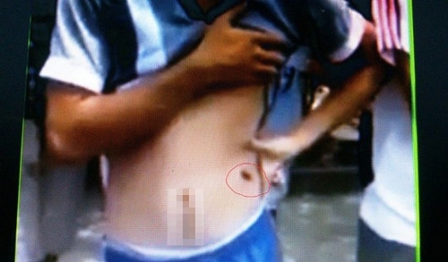 Tạm đình chỉ 1 CSGT bắn đạn cao su vào người vi phạm giao thông