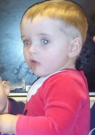 Mẹ phát hiện con nhỏ bị ung thư nhờ chụp ảnh bằng iphone