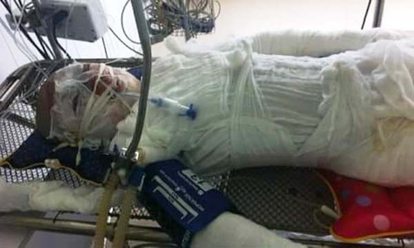 Đi câu cá, 4 học sinh bị điện cao thế phóng cháy người