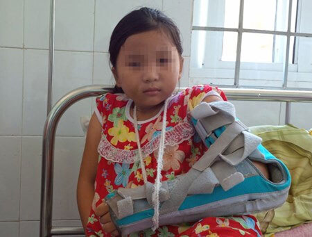 Phẫn nộ bé gái 10 tuổi bị cha đánh bầm dập, vứt xuống giếng vì mâu thuẫn với mẹ