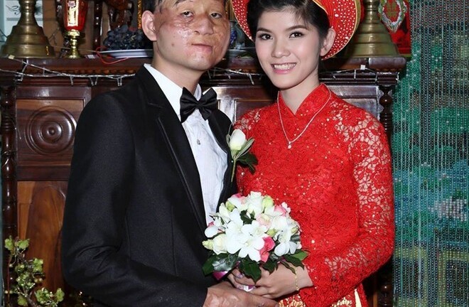 Những chuyện tình đũa lệch gây chú ý trên mạng