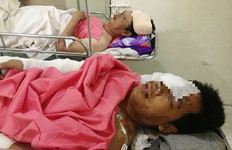 Trách nhiệm bồi thường khi bị tai nạn lao động